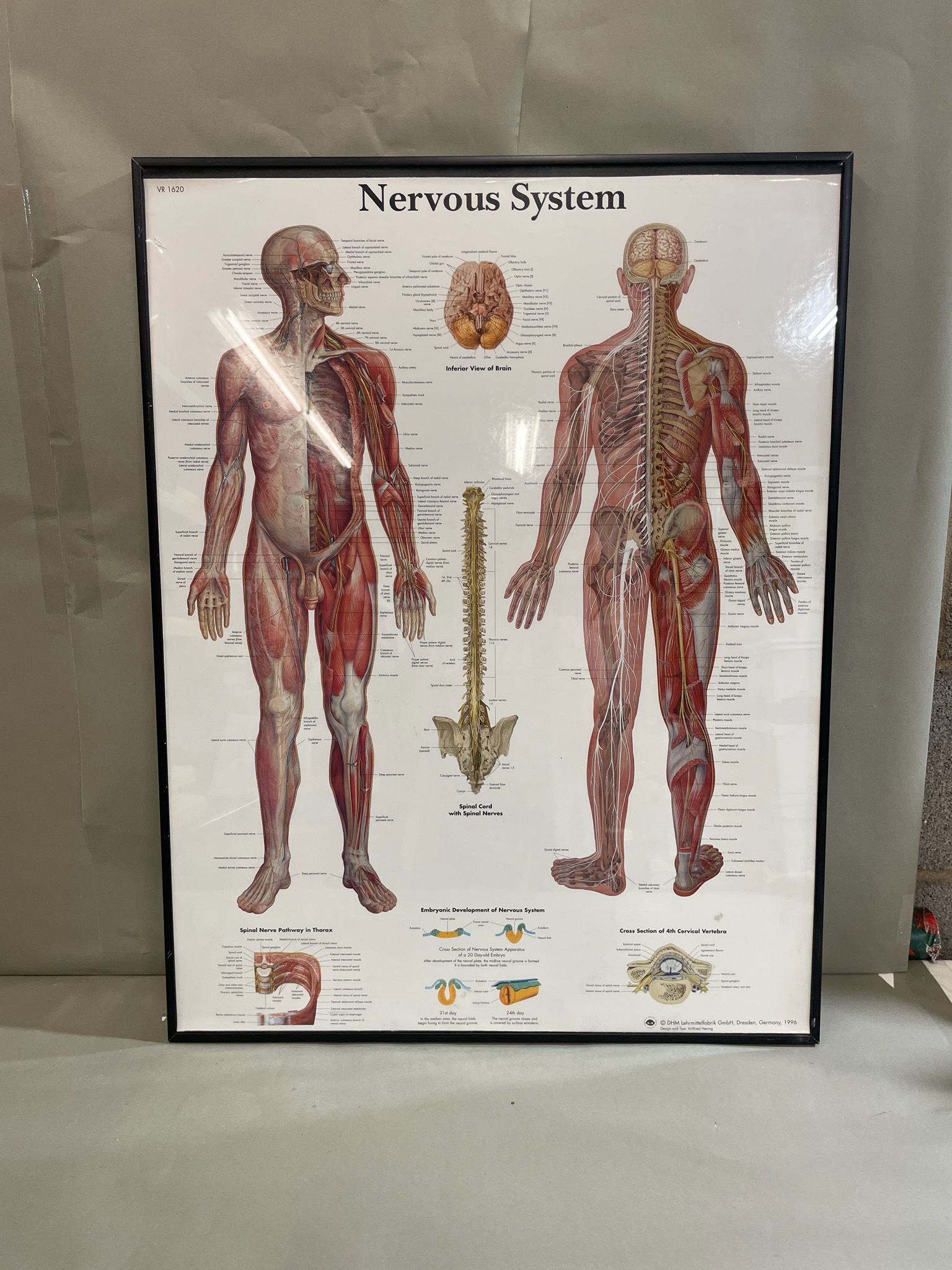 DHM Lehrmittelfabrik GmbH Black Framed Nervous System Poster